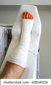 Broken Ankle After Surgery In Hospital