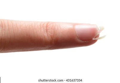 Broken Finger Nail