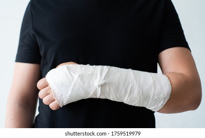 A Broken Hand In A Gypsum Bandage. Painful Heavy Movements Of Broken Finger Hands Close-up