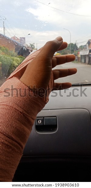 Broken hands as a result of negligence in driving\
on the highway