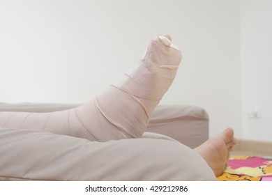 Broken Leg Stock Photo 429212986 | Shutterstock