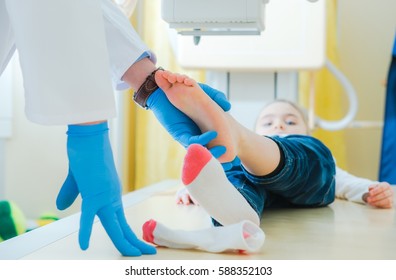 Broken Leg of Little Children X Ray Scanning. Radiology Imaging. Radiologist Preparing Girl for the Scan.