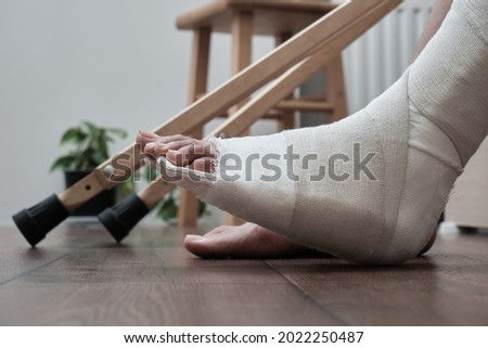 Broken leg in a plaster cast, near a crutches. Home rehabilitation after a broken leg. High quality photo