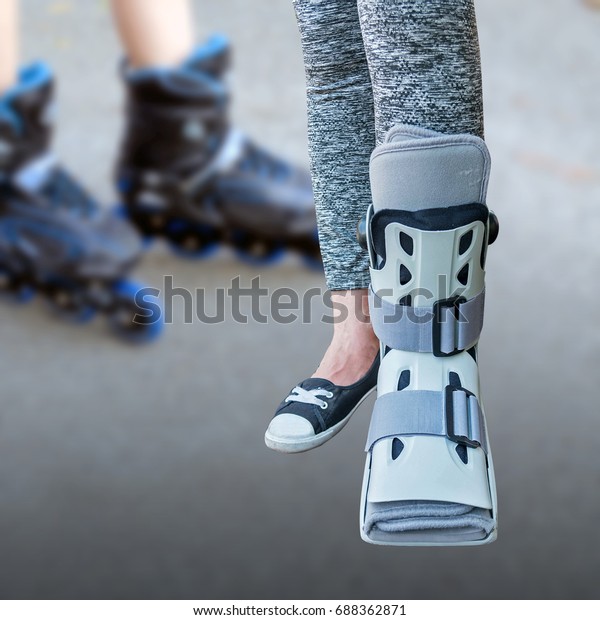 Broken Leg Short Leg Cast Splint Stock Photo 688362871 | Shutterstock