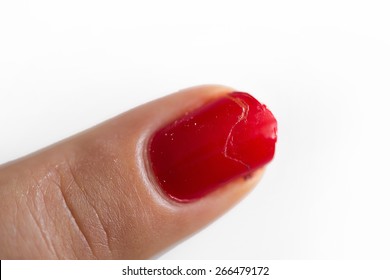 Broken Nail