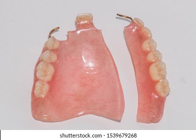 Broken Partial Plastic Upper Jaw Prosthesis