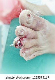 broken toe Images, Stock Photos & Vectors | Shutterstock