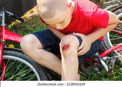 Broken Wounded Knee Child. European Boy In Red T-shirt And Denim Shorts Fell Off Bike And Looks At Wound Abrasion. Concept Children's Summer Holidays, Childhood