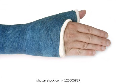 Broken Wrist, Arm With A Blue Fiberglass Cast On A White Background