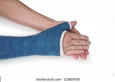 Broken Wrist, Arm With A Blue Fiberglass Cast On A White Background