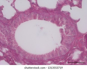 Bronchiole (lung) under the microscope