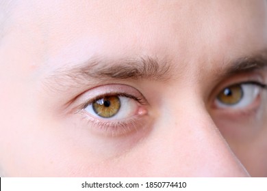 Brown Eyes Of A Young Man Close Up, Human Vision Concept, Optic Nerve Health, Nervous Tic, Myopia, Hyperopia, Vision Test