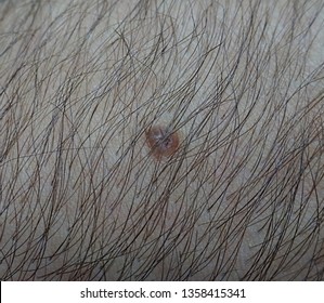 Hairy Mole Images, Stock Photos & Vectors | Shutterstock