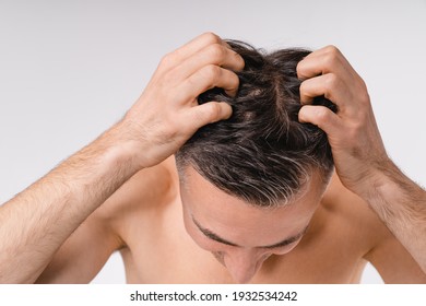 Brown-haired handsome man showing his hairline for some dandruff shirtless isolated over white background