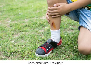 Bruise On Boys Leg On Lawn Stock Photo (edit Now) 426538732