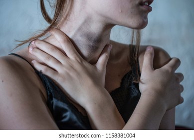 A Bruise On The Neck Of A Girl