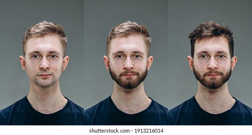 Brunette. Collage Of Man Before And After Visiting Barbershop, Client's Delighted With Different Haircut, Mustache, Beard. Concept Of Bodycare, Male Beauty, Comparison. Shaving, Hairstyling, Coloring.