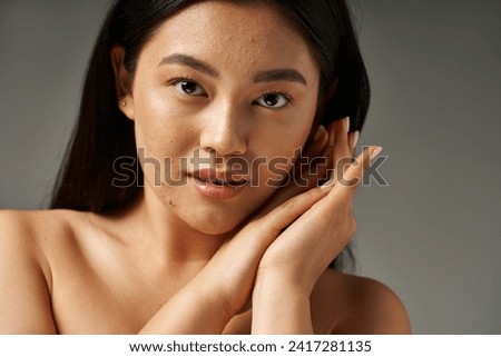 brunette young asian girl with skin issues and bare shoulders looking at camera on grey background