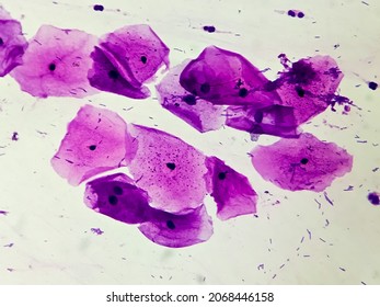 Buccal smear showing desquamated squamous cells of the oral mucosae. Small bluish points located mainly on the right cell are bacteria. Light micrograph. HE stain. - Shutterstock ID 2068446158