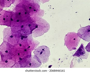 Buccal Smear Showing Desquamated Squamous Cells Of The Oral Mucosae. Small Bluish Points Located Mainly On The Right Cell Are Bacteria. Light Micrograph. HE Stain.