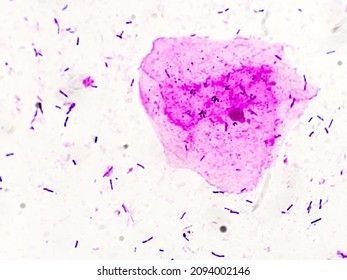 Buccal Smear Showing Desquamated Squamous Cells Of The Oral Mucosae. Small Rods Shape Bacilli And Coccus Bacteria. Light Micrograph. HE Stain.