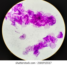 Buccal Smear Showing Desquamated Squamous Cells Of The Oral Mucosa. Small Bluish Points Located Mainly On The Right Cell Are Bacteria. Light Micrograph. HE Stain.