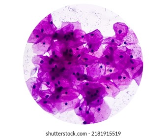 Buccal smear showing desquamated squamous cells of the oral mucosa. Small bluish points located mainly on the right cell are bacteria. Light micrograph. HE stain. - Shutterstock ID 2181915519