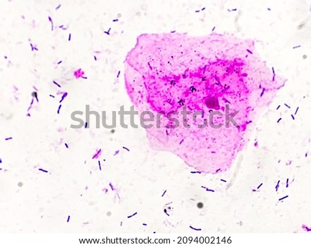 Buccal smear showing desquamated squamous cells of the oral mucosae. Small rods shape bacilli and coccus bacteria. Light micrograph. HE stain.
