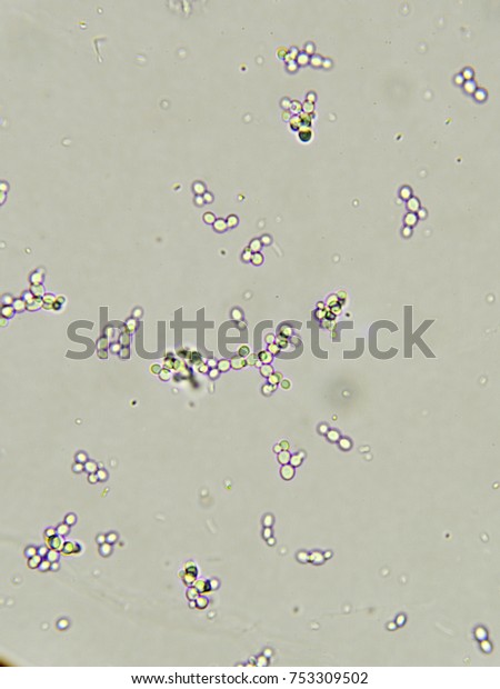 Budding Yeast Cells Patient Urine Urinary Stock Photo (Edit Now) 753309502