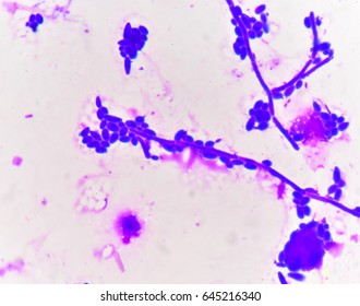 Budding Yeast Cells Pseudohyphae Gram Stain Stock Photo 645216340 ...