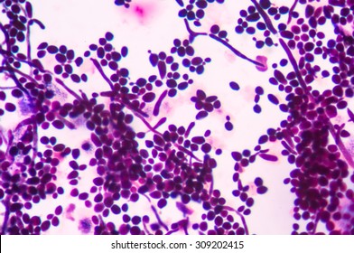 871 Budding yeast cell Images, Stock Photos & Vectors | Shutterstock