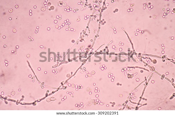 Photo De Stock Budding Yeast Cells Pseudohyphae Urine Sample 309202391 Shutterstock