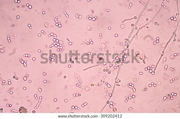 Budding Yeast Cells Pseudohyphae Urine Sample Stock Photo (Edit Now