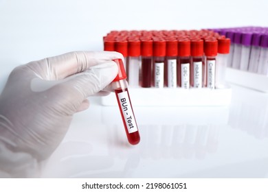 Bun Test Blood Blood Samples Be Stock Photo 2198061051 | Shutterstock