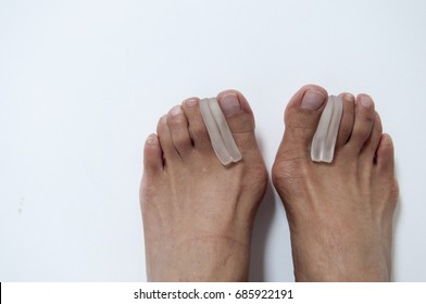 Bunion Feet With Toe Separators