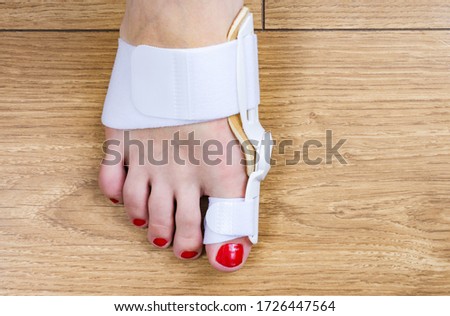 Bunion on big toes of female feet. Woman's leg with a special medical splint to treat and prevent painful Hallux Valgus. 