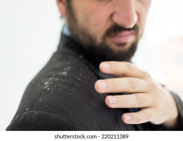 Business Man Having Man Dandruff In The Hair