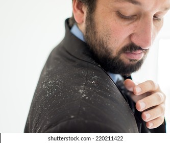 Business Man Having Man Dandruff In The Hair