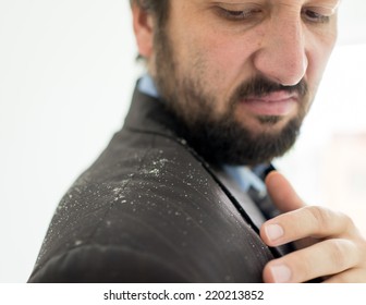 Business Man Having Man Dandruff In The Hair