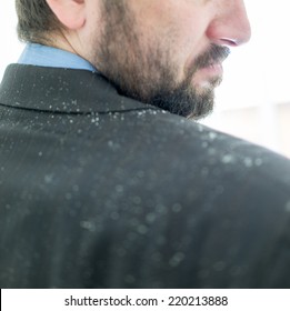 Business Man Having Man Dandruff In The Hair