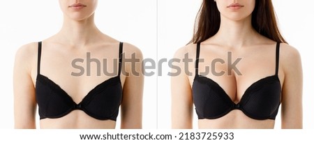 Bust of a woman before and after breast augmentation surgery. Woman in bra with different sizes of breast on white background. Plastic surgery concept.