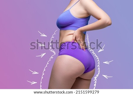 Buttocks, hip, abdomen liposuction, fat and cellulite removal concept, overweight female body with painted surgical lines and arrows on a purple background with a gradient