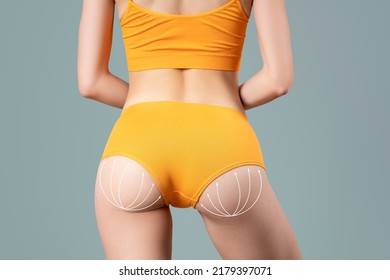 Buttocks liposuction, fat and cellulite removal concept, skinny female body with painted surgical lines on gray background