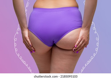 Buttocks liposuction, fat and cellulite removal concept, overweight female body with painted lines on a purple background with a gradient - Shutterstock ID 2185095103
