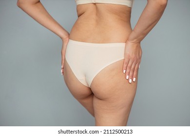 Buttocks Of A Young Woman On A Light Background. Cellulite Problem Concept.