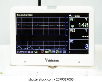 Cairo, Egypt, November 21 2021: Cardiotocography device placed on mother's abdomen recording the fetal heart rate obtained via ultrasound transducer, CTG is used to assess fetal well-being        