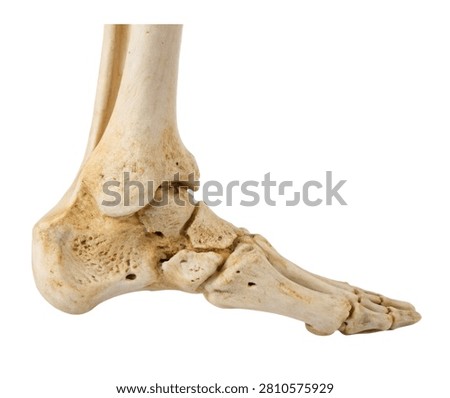 Calcaneus Heel Bone Shown In Side View Emphasiz Isolated On White Background