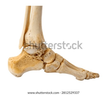 Calcaneus Heel Bone Shown In Side View Emphasiz Isolated On White Background