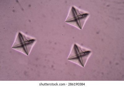 Calcium Oxalate Crystal In Urine Analysis.