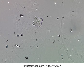 Calcium Oxalate Crystal Urine Sample Stock Photo 1157197027 | Shutterstock